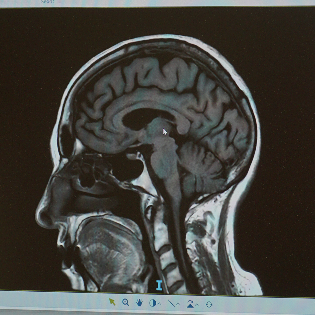 Servicio de neurología en Clínica Promosalud de Logroño