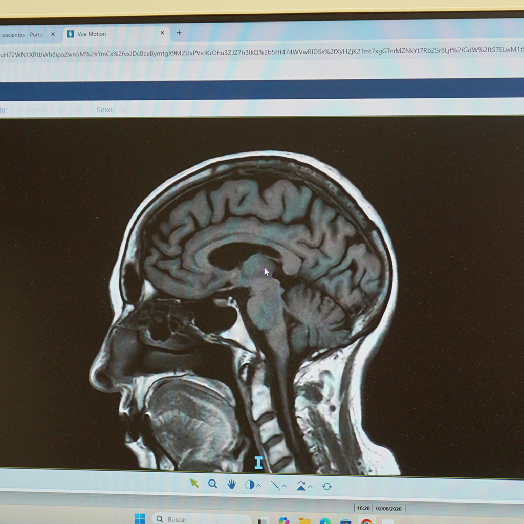 Servicio de neurología en Clínica Promosalud de Logroño