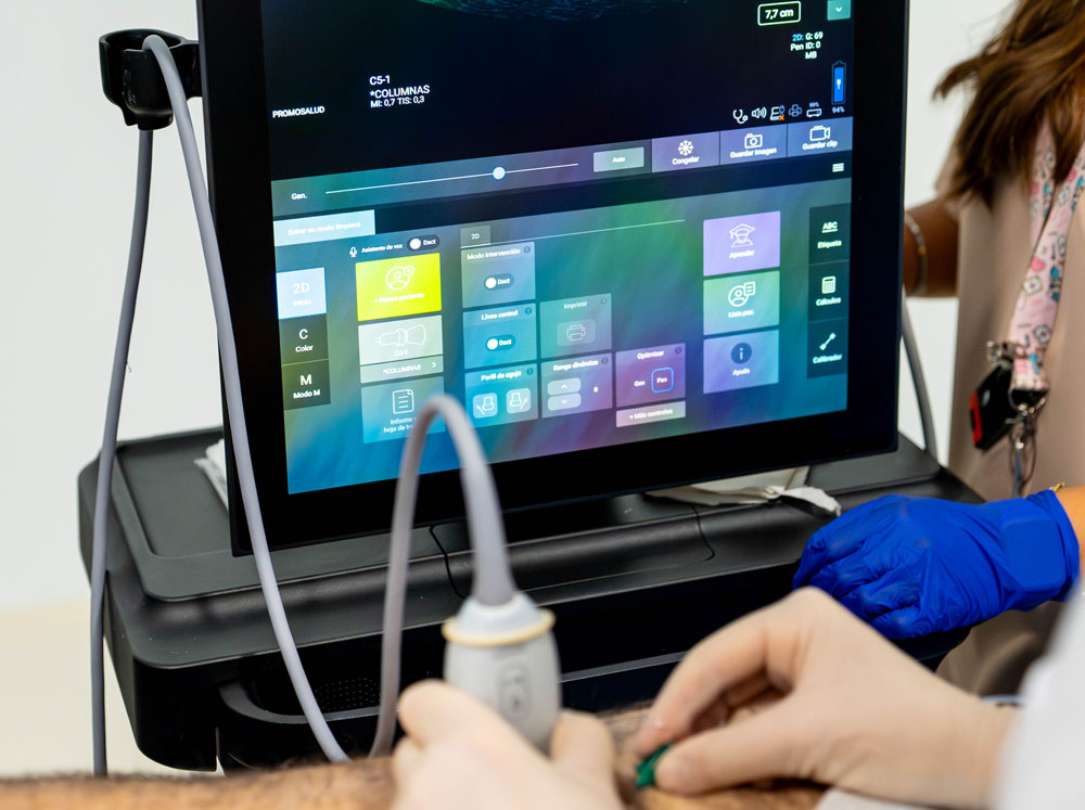 Ecógrafo de la Unidad del Dolor de Promosalud Logroño